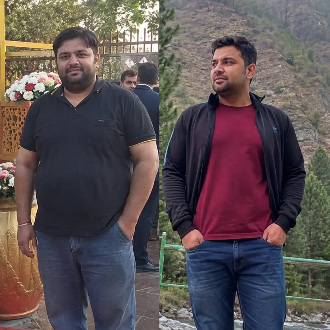 Suraj before-and-after progress photos